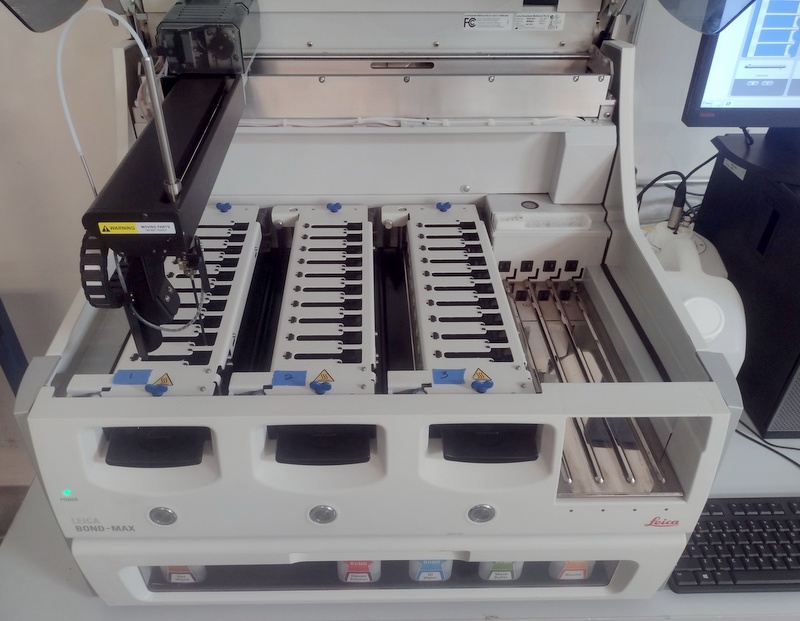 BOND-MAX IHC and ISH Automated Staining System